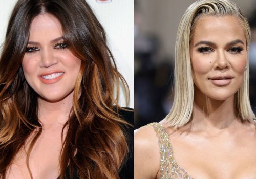 Do people feel better after cosmetic surgery?